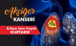 Akciğer kanserinin belirtileri neler?