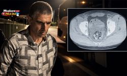 Midesinde uy*şturucu taşıyordu! Nevşehir’de yakalanan şüpheli hayatını kaybetti