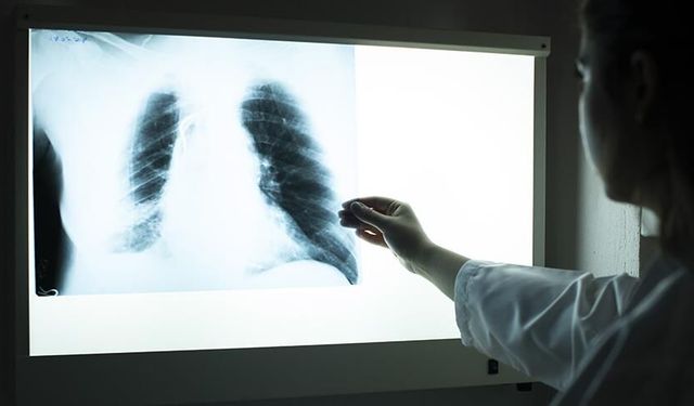 Nevşehir’de yoğun polikliniklere mesai dışı çözüm