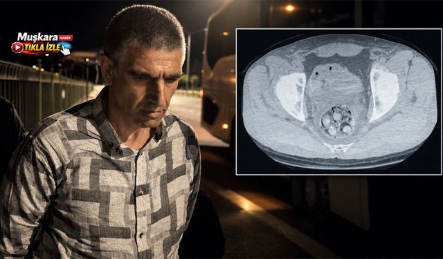Midesinde uy*şturucu taşıyordu! Nevşehir’de yakalanan şüpheli hayatını kaybetti